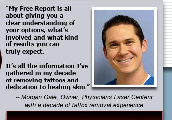 Tattoo Removal Specialist